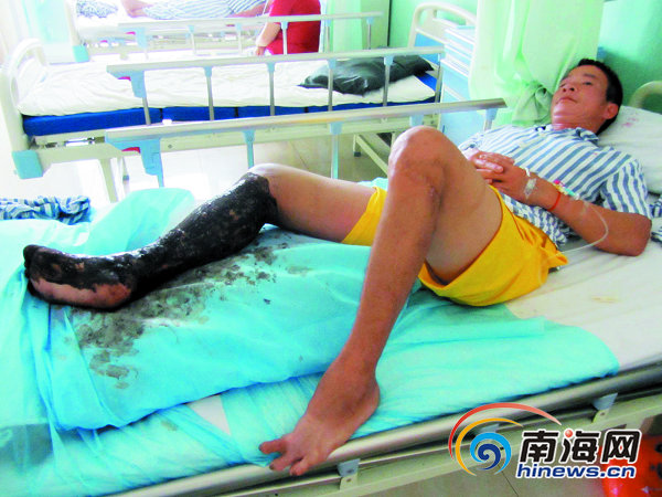 游客三亚遭遇蛇咬身亡事件，警示与反思